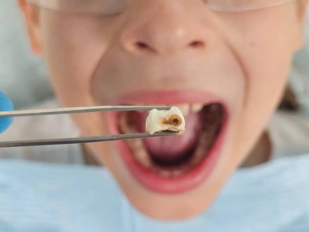 Best Emergency Dentist for Special Needs Patients in Leesburg, VA